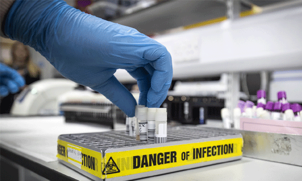 കോവിഡിന് പുതിയ മരുന്ന് പരീക്ഷണം; 3200 പേരില്‍ നാലുതരം ചികിത്സകള്‍ നടത്തും; പ്രതീക്ഷയര്‍പ്പിച്ച് ലോകം 