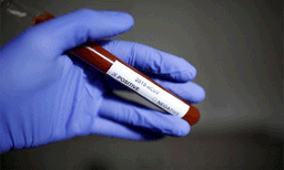 കൊറോണ തമാശയല്ല; ഗുരുതരമായാല്‍ കൈവിട്ടുപോകുമെന്ന് മുന്നറിയിപ്പ് നല്‍കി ഫുട്‌ബോള്‍ താരം ലീ ഡഫി 
