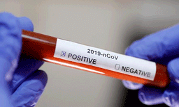 കൊറോണ വൈറസിനെ അതിജീവിച്ചവരുടെ രക്തം നിലവിലെ രോഗികള്‍ക്ക് നല്‍കും; പുതിയ മരുന്ന് പരീക്ഷണവുമായി അമേരിക്ക