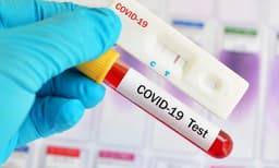 10 ദിവസത്തേക്ക് 2.31 ലക്ഷം, ഡോക്ടര്‍മാര്‍ക്ക് ചെലവ് 9,600, മരുന്നിനും ഉപകരണങ്ങള്‍ക്കും വേറെ ബില്ല് ; തമിഴ്‌നാട് സ്വകാര്യ ആശുപത്രികള്‍ക്ക് കോവിഡ്  ചാകര