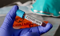 കരിപ്പൂര്‍ വിമാനത്താവളത്തിലെ ജീവനക്കാരന് കോവിഡ് ; ഇയാളുമായി സമ്പര്‍ക്കമുണ്ടായ ഒട്ടേറെ പേര്‍ നിരീക്ഷണത്തില്‍ 