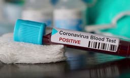 ആലപ്പുഴയില്‍ ഒരു കുടുംബത്തിലെ 11 പേര്‍ക്ക് കൊവിഡ് സ്ഥിരീകരിച്ചു