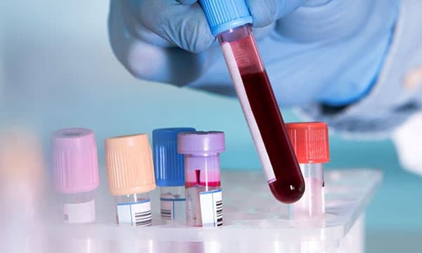 അത്യപൂര്‍വ രക്തം തേടി ഒരു കുരുന്ന് ജീവന്‍...;  ഇന്ത്യയില്‍ ആകെ രണ്ടുപേര്‍ക്ക്, രക്തത്തിനായി ആഗോള തിരച്ചില്‍