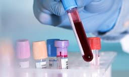 അത്യപൂര്‍വ രക്തം തേടി ഒരു കുരുന്ന് ജീവന്‍...;  ഇന്ത്യയില്‍ ആകെ രണ്ടുപേര്‍ക്ക്, രക്തത്തിനായി ആഗോള തിരച്ചില്‍