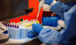 സ്വകാര്യ ലാബുകളിലെ പരിശോധന വെല്ലുവിളി; ഫലം ആരോഗ്യവകുപ്പിനെ അറിയിക്കുന്നതില്‍ വീഴ്ച