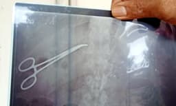 മെഡിക്കല്‍ കോളജില്‍ മധ്യവയസ്‌കന്റെ ശരീരത്തില്‍ ശസ്ത്രക്രിയാ ഉപകരണം വച്ച് തുന്നിച്ചേര്‍ത്തു ; ഓപ്പറേഷന് സ്വകാര്യ ആശുപത്രിയില്‍ എത്താന്‍ പറഞ്ഞത് അവഗണിച്ചതിന് മനപ്പൂര്‍വ്വം ചെയ്തതെന്ന് പരാതി