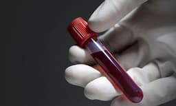 ഒടുവില്‍ അപൂര്‍വ രക്തമെത്തി; ഇനി അനുഷ്‌കയ്ക്ക് ശസ്ത്രക്രിയ