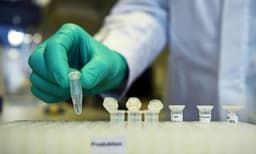 പ്ലാസ്‍മ തെറാപ്പി ചികിത്സയിലൂടെ കൊവിഡ് ഭേദമായ ആലപ്പുഴ സ്വദേശി മരിച്ചു