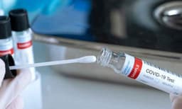 ആരിക്കാടി കടപ്പുറത്തെ ആളുകള്‍ ആന്റിജന്‍ പരിശോധനയ്ക്ക് തയ്യാറാകുന്നില്ല; പരാതിയുമായി ആരോഗ്യപ്രവര്‍ത്തകര്‍