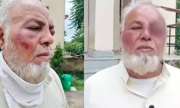 'ജയ്ശ്രീറാമും മോദി സിന്ദാബാദും വിളിച്ചില്ല': രാജസ്ഥാനില്‍ ഓട്ടോ ഡ്രൈവര്‍ക്ക് ക്രൂരമര്‍ദ്ദനം, പാക്കിസ്ഥാനിലേക്ക് പോകാനും ആക്രോശം