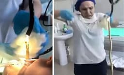 ശസ്ത്രക്രിയയിലൂ​ടെ സ്ത്രീയുടെ വായയിലൂടെ പുറത്തെടുത്തത് നാലടിയോളം നീളമുള്ള പാമ്പിനെ ; വീഡിയോ