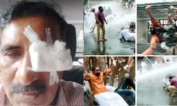 ജലീലിന്റെ രാജി ആവശ്യപ്പെട്ടുകൊണ്ടുള്ള മാര്‍ച്ചില്‍ സംഘര്‍ഷം: ബി. ഗോപാലകൃഷ്ണന് പരിക്ക്