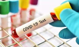 തലസ്ഥാനത്ത് ഇന്ന് 412 പേർക്ക് കോവിഡ് ; 300 കടന്ന് കോഴിക്കോട്, മലപ്പുറം, എറണാകുളം ജില്ലകള്‍ 