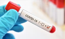 ചേര്‍ത്തലയില്‍ കുഴഞ്ഞ് വീണ് മരിച്ച് ബാങ്ക് ഉദ്യേഗസ്ഥന് കൊവിഡ് സ്ഥിരീകരിച്ചു