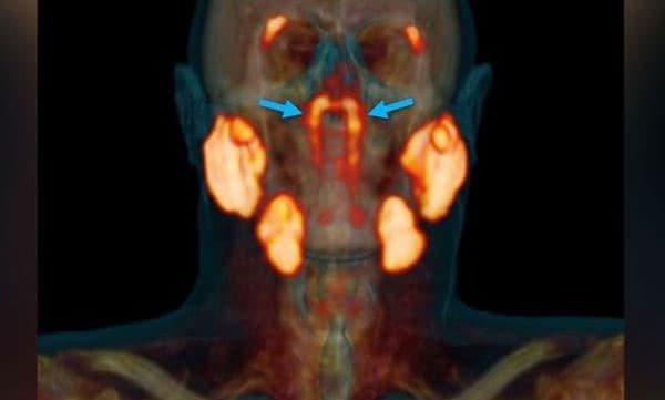 മനുഷ്യ ശരീരത്തില്‍ ഇതാ പുതിയൊരു അവയവം കൂടി...; പുതിയ കണ്ടെത്തല്‍ ഇങ്ങനെ 