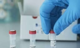 കൊവിഡ് ബാധിച്ചവരില്‍ പുതിയ പഠനം; തലച്ചോറിന്റെ പ്രായം 10 വര്‍ഷം കൂടുമെന്ന് കണ്ടെത്തല്‍