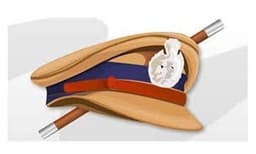 കോഴിക്കോട് അഞ്ച് പോലീസ് സ്‌റ്റേഷന്‍ പരിധികളില്‍ നിരോധനാജ്ഞ