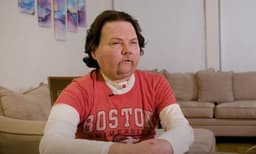 ആദ്യ മുഖം മാറ്റിവെക്കാൽ ശസ്ത്രക്രിയ വിജയം... ജോയ്ക്കിപ്പോള്‍ ചിരിക്കാം, ഹൃദയം തുറന്ന്