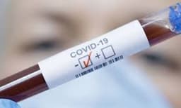 ആലപ്പുഴ ജില്ലയിലെ കൊവിഡ് വ്യാപനത്തില്‍ ആശങ്കയറിയിച്ച് കേന്ദ്രം 