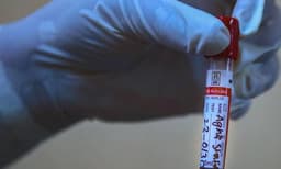 ചെറിയ ലക്ഷണങ്ങളുള്ളവരേയും ഇനി പരിശോധിക്കും: കോവിഡ് ചികിത്സയ്ക്ക് പുതിയ മാര്‍ഗരേഖ