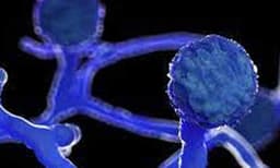 പുതിയ തലവേദന ബ്‌ളാക്ക് ഫംഗസ് ; 13 സംസ്ഥാനങ്ങളിലായി 7,250 പേര്‍, മരണം 219