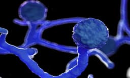 ബ്ലാക്ക് ഫംഗസ് ബാധിതരിൽ നിന്ന് ചികിത്സക്കായി വൻതുക വാങ്ങുന്നുവെന്ന് ആരോപണം