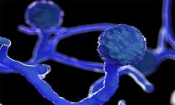 ബ്ലാക്ക് ഫംഗസ്: കര്‍ണാടകയില്‍ മരിച്ചത് 303 പേര്‍; 34% മരണവും ബംഗലുരുവില്‍