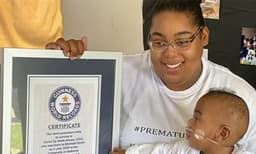 മാസം തികയാതെ ജനിച്ച കുഞ്ഞിനു ഗിന്നസ് റെക്കോര്‍ഡ്