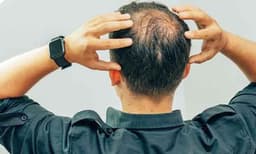 കഷണ്ടി ചികിത്സയ്ക്ക് ലേസര്‍ ഹെല്‍മറ്റ്: വേറിട്ട ചികിത്സയുമായി എയിംസ് ആശുപത്രി