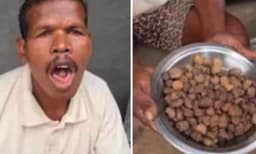 കല്ലു വിഴുങ്ങിയാല്‍ രോഗം മാറുമത്രെ, ഇതുവരെ തിന്നത് ഒരു ചാക്ക് കല്ല്