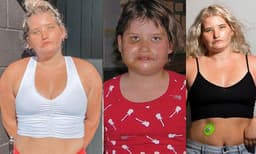 ചിരിക്കാനോ കണ്‍പുരികങ്ങള്‍ ചലിപ്പിക്കാനോ ആവില്ല; ആത്മഹത്യയ്ക്ക് ശ്രമിച്ചത് 6 തവണ: ഒടുവില്‍...