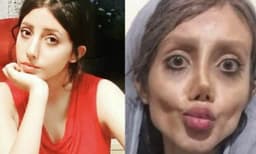 ആഞ്ജലിന ജോളിയുടെ അപരയാകാൻ ശ്രമം; 50 പ്ളാസ്‌റ്റിക് സർജറികൾ ​നടത്തി; പെൺകുട്ടിയുടെ യഥാർത്ഥമുഖം പുറത്ത്
 
