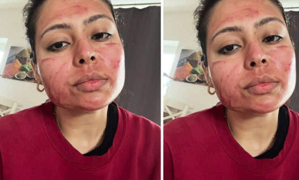 ചര്‍മ്മ സംരക്ഷണത്തിനായി രക്തം ! വൈറല്‍ കുറിപ്പിന്റെ പിന്നിലെ യാഥാര്‍ത്ഥ്യം