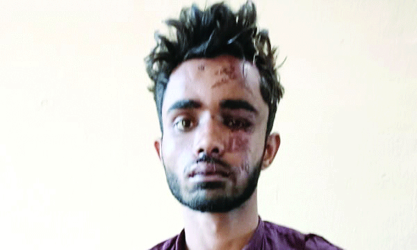 ട്രെയിന്‍ തീവയ്പ്പ് കേസില്‍ തീവ്രവാദ സ്വഭാവം കണ്ടെത്താനാതെ പോലീസ് ; ഡല്‍ഹിയില്‍നിന്ന് ഷൊര്‍ണൂരിലെത്തിയ ഷാരൂഖ് ട്രെയിനില്‍ കയറുന്നത് വരെ എന്തു ചെയ്യുകയായിരുന്നു? 