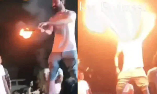 ഇതാണ് തീക്കളി അപകടമാണെന്ന് പറയുന്നതിന് കാരണം ; സ്റ്റണ്ടിനിടയില്‍ യുവാവിന്റെ മുഖത്തേക്ക് തീ ആളിപടര്‍ന്നു, കൂട്ടുകാര്‍ രക്ഷിച്ചു