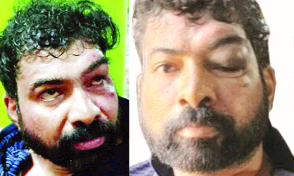 ലഹരിക്ക് അടിമയായതിനെത്തുടര്‍ന്നു ഡീ അഡിക്ഷന്‍ സെന്ററില്‍നിന്ന് പുറത്തിറങ്ങിയത് അടുത്തിടെ ; കൊല്ലാന്‍വരുന്നെന്ന് വിളിച്ചുകൂവി രാത്രി പോലീസിന് ഫോണ്‍ ചെയ്തതും സന്ദീപ്