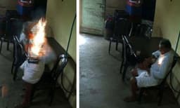 ഷര്‍ട്ടിന്റെ പോക്കറ്റില്‍ കിടന്ന മൊബൈൽ ഫോൺ പൊട്ടിത്തെറിച്ചു; 76-കാരന് പൊള്ളലേറ്റു

