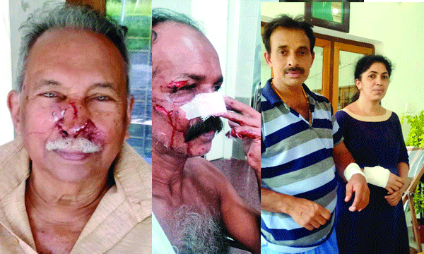 രാമപുരം പഞ്ചായത്തില്‍ പലയിടത്ത് കുറുക്കന്റെ ആക്രമണത്തില്‍ നാലു പേര്‍ക്ക് പരിക്ക് ; ജോസ് എറിഞ്ഞോടിക്കാന്‍ കല്ലെടുക്കാന്‍ കുനിഞ്ഞു, ഉടന്‍ ചാടി മൂക്കില്‍ കടിച്ചു 