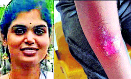 കാര്‍ഷിക കോളജിലെ ഹോസ്റ്റലില്‍ ആന്ധ്രാക്കാരിക്ക് കേട്ടുകേഴ്വിയില്ലാത്ത ക്രൂരപീഡനം; ദീപികയെ കസേരയില്‍ കെട്ടിയിട്ടു ; ചൂടുപാത്രം കറിയോടെ എടുത്ത് മുഖത്ത് പൊള്ളിച്ചു 