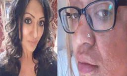 
ടിക്‌ടോക്ക് ട്രെന്‍ഡ് പരീക്ഷണം; മുട്ട പൊട്ടിത്തെറിച്ച് യുവതിയുടെ മുഖത്ത് ഗുരുതരമായി പൊളളലേറ്റു