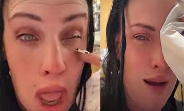 തുള്ളി മരുന്നിനു പകരം സൂപ്പര്‍ ഗ്ലൂ കണ്ണില്‍ ഒഴിച്ചു, കണ്‍പീലികള്‍ ഒട്ടിപ്പോയി; അനുഭവം പങ്കിട്ട് യുവതി
