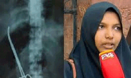 ഹർഷിനയുടെ വയറ്റിൽ കത്രിക കുടുങ്ങിയ ​േ​കസ്; ആരോഗ്യവകുപ്പ് പ്രതിനിധികൾ മനുഷ്യാവകാശ കമ്മീഷൻ സിറ്റിങ്ങിൽ  ഹാജരായില്ല