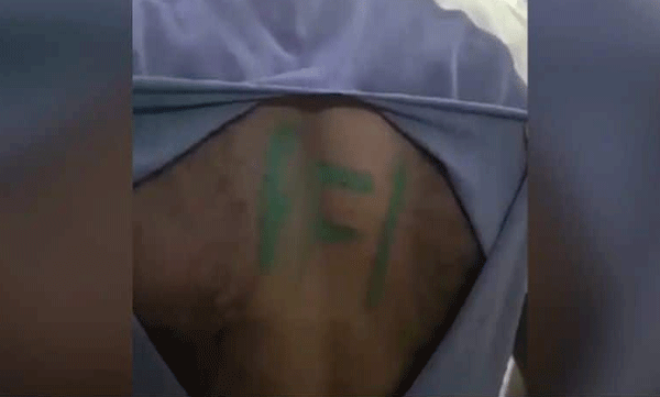 കൊല്ലത്ത് സൈനികനെ ആക്രമിച്ച്  പുറത്ത് പിഎഫ്ഐ എന്നെഴുതി;  സംഭവത്തില്‍ അന്വേഷണം ആരംഭിച്ച് പോലീസും സൈന്യവും 