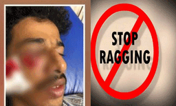 ചാത്തമംഗലം എംഇഎസ് കോളജിലെ മർദനം: ഏഴ് വിദ്യാർത്ഥികൾക്ക് സസ്‌പെന്‍ഷന്‍
