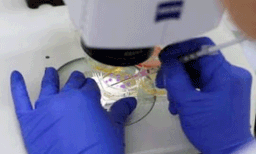 ക്യാൻസർ പരിശോധനയ്ക്കിടെ സ്ത്രീക്ക് പൊള്ളലേറ്റ സംഭവം: ഉപയോഗിച്ചത് ഗുണനിലവാരമുള്ള ആസിഡെന്ന്  ഡി.എം.ഒ
