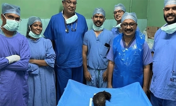 കുട്ടിക്ക് വിശപ്പില്ല, സ്കാൻ റിപ്പോർട്ടിൽ ഞെട്ടി ഡോക്ടർമാർ; വയറ്റില്‍ രണ്ടു കിലോ ഭാരമുള്ള ഭീമന്‍ മുടിക്കെട്ട്
