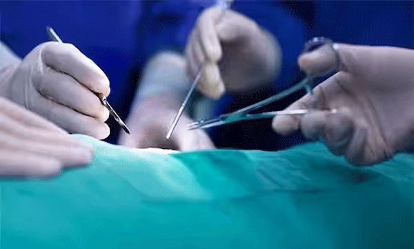 ഒരു വർഷം മുന്‍പ്  നടന്ന ശസ്ത്രക്രിയയുടെ മുറിവ് ഉണങ്ങിയില്ല; ചികിത്സാ പിഴവില്‍ ഇടപെട്ട് വനിത കമ്മീഷൻ