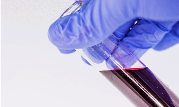 ഷെയ്‌നില്‍ നിന്നും വസ്ത്രം ഓര്‍ഡര്‍ ചെയ്തു; യുവതിക്ക് കിട്ടിയത് ഒരു കുപ്പി രക്തവും ബീന്‍സ് വിത്തുകളും: സംഭവം ഇങ്ങനെ..
