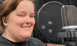  സെല്‍ഫി രക്ഷകനായി ; യുവതിയുടെ തലച്ചോറില്‍ നിന്നും നീക്കം ചെയ്തത് ' മെനിഞ്ചിയോമ' മുഴ