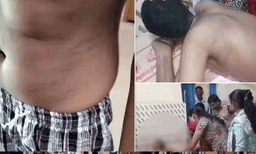 സ്പെഷൽ സ്കൂളിൽ ഭിന്നശേഷിക്കാരനായ  16കാരന്  ക്രൂര മർദ്ദനമേറ്റതായി പരാതി